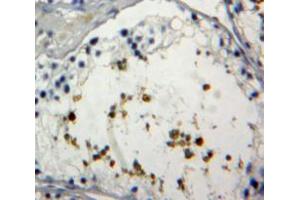 IHC-P analysis of Testis tissue, with DAB staining.