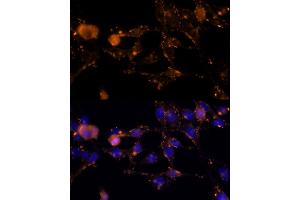 Immunofluorescence analysis of HeLa cells using AREG Rabbit pAb (ABIN6127431, ABIN6137065, ABIN6137066 and ABIN6216408) at dilution of 1:100 (40x lens).