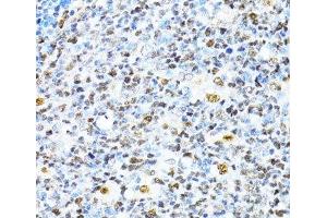 Immunohistochemistry of paraffin-embedded Human appendix using XRCC4 Polyclonal Antibody at dilution of 1:100 (40x lens). (XRCC4 anticorps)