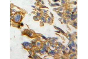 IHC-P analysis of ovary tissue, with DAB staining. (NRP2 anticorps  (AA 231-490))