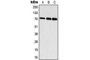 Western blot analysis of S6K1 (pT444) expression in HepG2 EGF-treated (A), mouse brain (B), rat brain (C) whole cell lysates. (RPS6KB1 anticorps  (C-Term, pSer444))