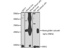 Western blot analysis of extracts of various cell lines, using Hemoglobin subunit alpha (Hemoglobin subunit alpha (HB)) antibody (ABIN6128046, ABIN6141635, ABIN6141636 and ABIN6223164) at 1:1000 dilution. (HBA1 anticorps  (AA 1-142))