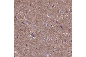 ABIN6266756 at 1/100 staining human brain tissue sections by IHC-P. (ANKRD26 anticorps  (Internal Region))
