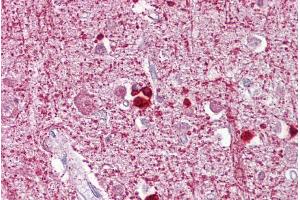 Immunohistochemistry with Brain, cortex tissue at an antibody concentration of 5µg/ml using anti-ZEB2 antibody (ARP33695_P050)