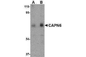 Western blot analysis of CAPN6 in rat lung tissue lysate with AP30177PU-N CAPN6 antibody at (A) 0. (Calpain 6 anticorps  (C-Term))