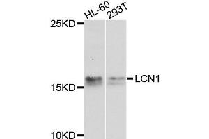 Western blot analysis of extracts of HL60 and 293T cells, using LCN1 antibody. (Lipocalin 1 anticorps)