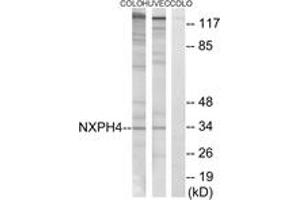 Western blot analysis of extracts from COLO/HuvEc cells, using NXPH4 Antibody. (Neurexophilin 4 anticorps  (AA 216-265))