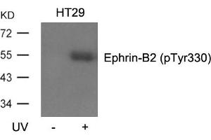 Western blot analysis of extracts from HT29 cells, untreated or treated with UV using Ephrin-B2(Phospho-Tyr330) Antibody. (Ephrin B2 anticorps  (pTyr330))