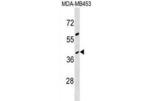 Western Blotting (WB) image for anti-Olfactory Receptor, Family 10, Subfamily G, Member 8 (OR10G8) antibody (ABIN3000509) (OR10G8 anticorps)