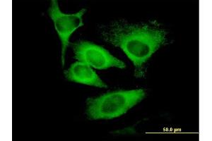 Immunofluorescence of monoclonal antibody to EIF5 on HeLa cell. (EIF5 anticorps  (AA 1-431))