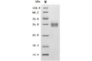 Epithelial Cell Adhesion Molecule (EPCAM) (AA 24-265) (Active) protein (His tag)