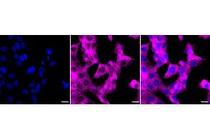 Immunocytochemical staining of HT- cells with CTP synthase 1 antibody (ABIN7798174), 1:1,000). (Recombinant CTP Synthase anticorps)