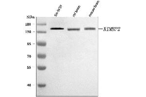 Western blot analysis of RIMBP2 using anti-RIMBP2 antibody (ABIN7601441). (RIMBP2 anticorps  (AA 351-1049))