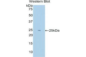 Detection of Recombinant HIF2a, Human using Polyclonal Antibody to Hypoxia Inducible Factor 2 Alpha (HIF2a)