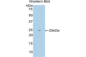 Detection of Recombinant HIF2a, Human using Polyclonal Antibody to Hypoxia Inducible Factor 2 Alpha (HIF2a) (EPAS1 anticorps  (AA 339-541))