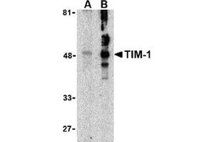 Western blot analysis of TIM-1 in human uterus tissue lysate with this product at (A) 1 and (B) 2 μg/ml. (HAVCR1 anticorps  (N-Term))