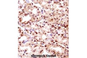 Immunohistochemistry (IHC) image for anti-Thymopoietin (TMPO) antibody (ABIN2998199) (Thymopoietin anticorps)