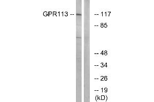 Western blot analysis of extracts from LOVO cells, using GPR113 antibody. (GPR113 anticorps  (Internal Region))