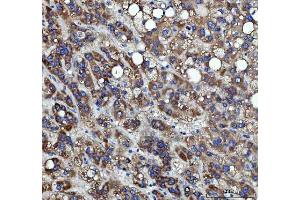 IHC analysis of RRS1 using anti-RRS1 antibody (ABIN7602918).