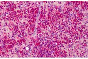 Human Spleen: Formalin-Fixed, Paraffin-Embedded (FFPE) (beta Actin anticorps  (C-Term))