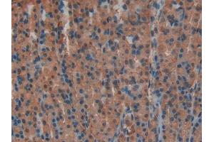 IHC-P analysis of Rat Stomach Tissue, with DAB staining. (Lactate Dehydrogenase A anticorps  (AA 1-332))