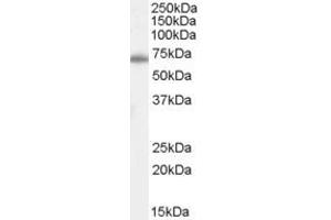 Western Blotting (WB) image for anti-Chymotrypsin-Like Elastase Family, Member 2A (CELA2A) (C-Term) antibody (ABIN2787346) (CELA2A anticorps  (C-Term))