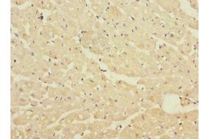 Immunohistochemistry of paraffin-embedded human heart tissue using ABIN7150306 at dilution of 1:100 (DNA2 anticorps  (AA 1-300))
