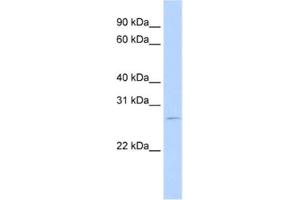 Western Blotting (WB) image for anti-RNA Binding Motif Protein 38 (RBM38) antibody (ABIN2462271) (RBM38 anticorps)