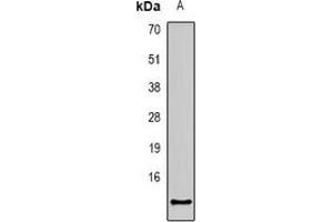Western blot analysis of CCL27 expression in mouse kidney (A) whole cell lysates.