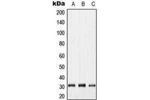 Western blot analysis of Connexin 31. (GJB5 anticorps  (Center))