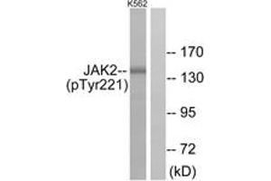 Western blot analysis of extracts from K562 cells, using JAK2 (Phospho-Tyr221) Antibody. (JAK2 anticorps  (pTyr221))