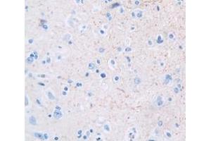 Used in DAB staining on fromalin fixed paraffin- embedded Kidney tissue