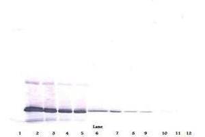 Image no. 4 for anti-Interleukin 11 (IL11) antibody (ABIN465144) (IL-11 anticorps)