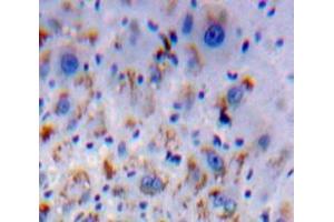 Used in DAB staining on fromalin fixed paraffin-embedded Liver tissue
