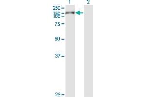 Western Blot analysis of KIAA1199 expression in transfected 293T cell line by KIAA1199 monoclonal antibody (M01), clone 3C12.