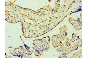 Immunohistochemistry of paraffin-embedded human placenta tissue using ABIN7176252 at dilution of 1:100