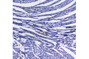 IHC analysis of MAX using anti-MAX antibody .