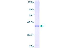Image no. 1 for T-Cell Leukemia/lymphoma 1B (TCL1B) (AA 1-128) protein (GST tag) (ABIN1322396)