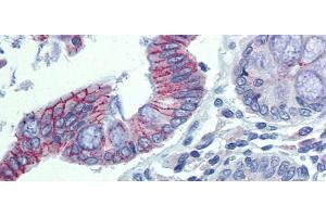 Immunohistochemistry with Human Colon lysate tissue at an antibody concentration of 5.
