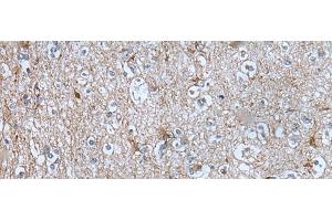 Immunohistochemistry of paraffin-embedded Human brain tissue using BMP1 Polyclonal Antibody at dilution of 1:105(x200) (BMP1 anticorps)