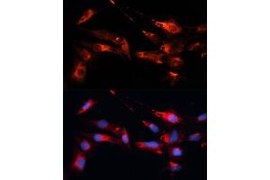 Immunofluorescence analysis of C6 cells using MB antibody (ABIN1680748, ABIN3017668, ABIN3017669 and ABIN6220205) at dilution of 1:100.