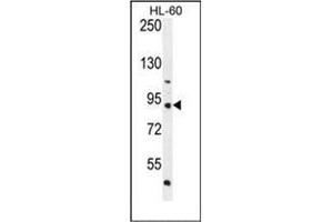 Western blot analysis of KIAA1586 Antibody (N-term) Cat. (KIAA1586 anticorps  (N-Term))