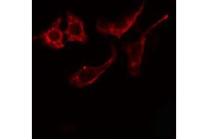 ABIN6274866 staining Hela cells by IF/ICC. (Arylsulfatase E anticorps  (Internal Region))