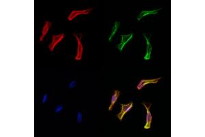 ABIN6261469 and ABIN6278061 staining Hela cells by IF/ICC. (EHD1 anticorps  (C-Term))