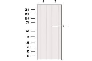 Western blot analysis of extracts from Hela, using TAIP-2 Antibody.