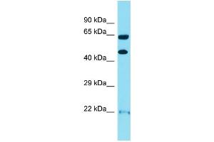 WB Suggested Anti-OPRK1 Antibody Titration:  1 ug/ml  Positive Control:  HuFetal Kidney (OPRK1 anticorps  (N-Term))