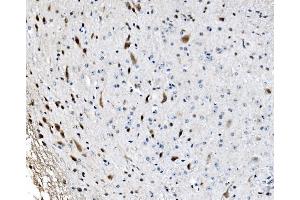 IHC analysis of GRX2/GLRX2 using anti-GRX2/GLRX2 antibody (ABIN7599022). (Glutaredoxin 2 anticorps  (AA 1-164))