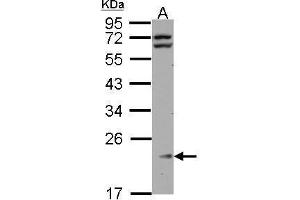 WB Image Sample (30 ug of whole cell lysate) A: HeLa 12% SDS PAGE antibody diluted at 1:1000 (RPL11 anticorps)