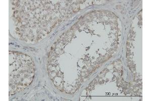 Immunoperoxidase of monoclonal antibody to MAP3K4 on formalin-fixed paraffin-embedded human testis.