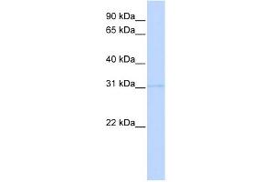 WB Suggested Anti-PRMT6 Antibody Titration:  0. (PRMT6 anticorps  (Middle Region))
